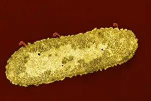 Gram Prints: Bacteriophage T-2 Infecting Escherichia coli, TEM