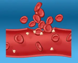 Clots Prints: Blood clot