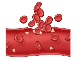 Circulation Prints: Blood clot