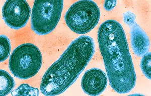 Micro Prints: Blue-Green Algae, TEM