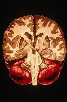 Section Prints: Brain, Coronal Section