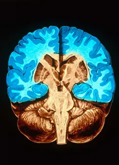 Section Prints: Brain, Coronal Section