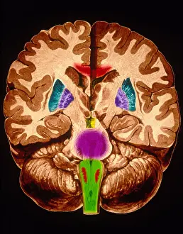 Section Prints: Brain, Coronal Section