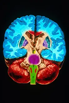 Section Prints: Brain, Coronal Section