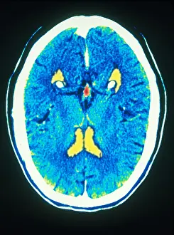 Medical Prints: Brain, CT Scan
