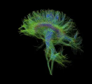 Magnetic Prints: Brain, Fiber Tractography Image