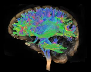 Magnetic Prints: Brain, Fiber Tractography Image