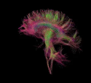 Magnetic Prints: Brain, Fiber Tractography Image
