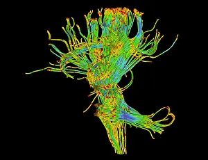 Magnetic Prints: Brain, Fiber Tractography Image