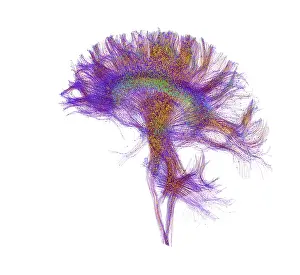 Magnetic Prints: Brain, Fiber Tractography Image