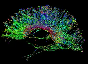 Magnetic Prints: Brain, Fiber Tractography Image