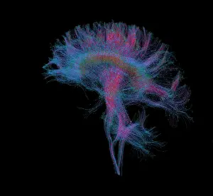 Magnetic Prints: Brain, Fiber Tractography Image