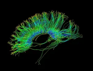Magnetic Prints: Brain, Fiber Tractography Image