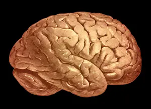 Medical Prints: Brain