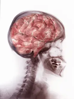 Concept Prints: Brain Inside Skull, Artwork on X-ray