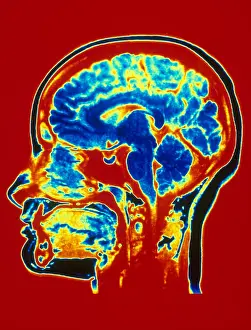 Magnetic Prints: Brain MRI