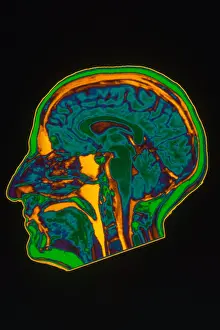 Magnetic Prints: Brain MRI