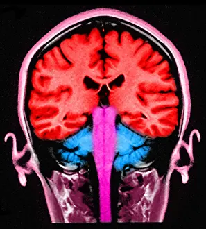 Magnetic Prints: Brain, Sagittal View, MRI