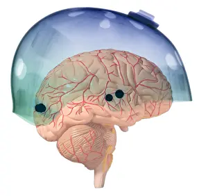 Radiography Prints: Brain in Skateboard Helmet