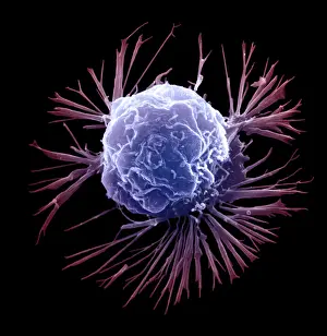 Breast Cancer Cell