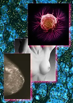Electron Prints: Breast Cancer Montage