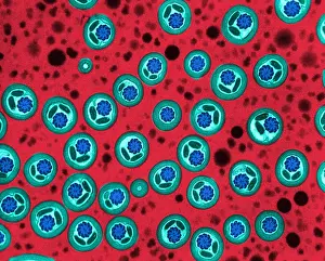 Reproductive Prints: Butterfly Sperm, TEM