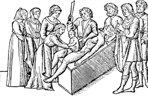 Operating Prints: Caesarean Section, 16th Century