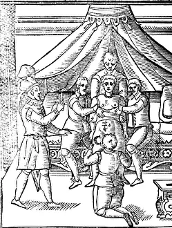 Operating Prints: Caesarean Section, 17th Century