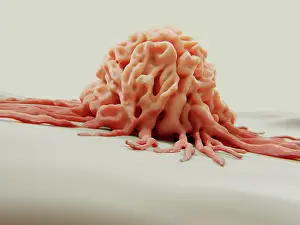 Pathological Prints: Cancer cell