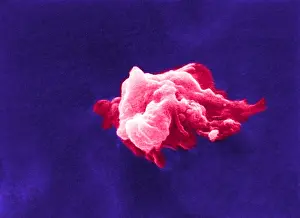 : Cancer Cell Death, Apoptosis, Under the Microscope, Sem 6 Of 6