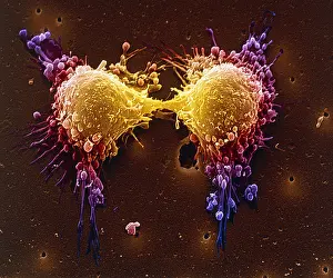 Bridge Prints: Cancer cell division