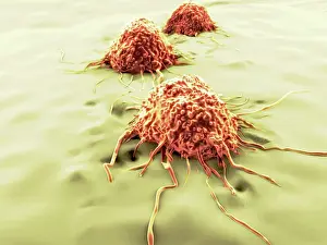 Pathological Prints: Cancer cells, artwork