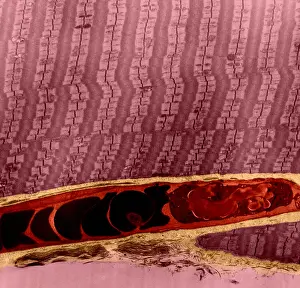 Fibers Prints: Capillary Between Muscle Fibers, TEM