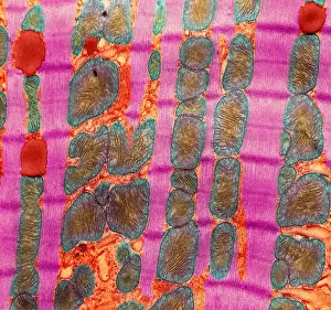 Fibers Prints: Cardiac Muscle, TEM