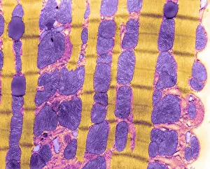 Fibers Prints: Cardiac Muscle, TEM