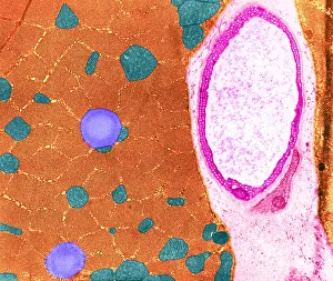 Fibers Prints: Cat Soleus Muscle, TEM