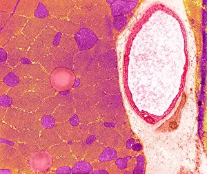 Fibers Prints: Cat Soleus Muscle, TEM