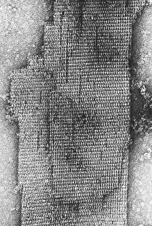 Hydrogen Prints: Catalase enzyme, TEM