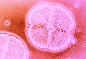Wall Prints: Cell Division, Arbacia Punctulata, light micrograph