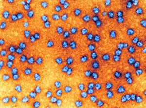 Lateral Prints: Cell Structure, Ribosomes, TEM