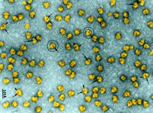 Lateral Prints: Cell Structure, Ribosomes, TEM