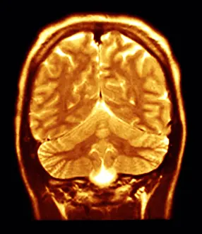 Magnetic Prints: Cerebral MRI