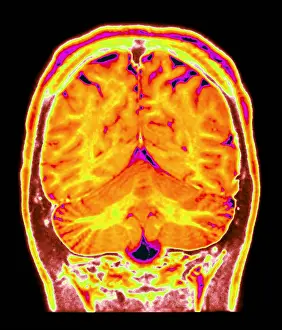 Magnetic Prints: Cerebral MRI