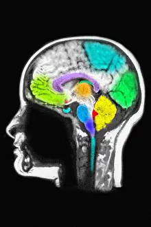 Magnetic Prints: Cerebral MRI
