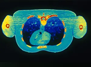 Project Prints: Chest & Heart, CT Scan