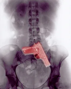 Weapon Prints: Chest x-ray showing hidden gun