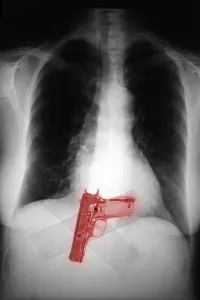 Weapon Prints: Chest x-ray showing hidden gun