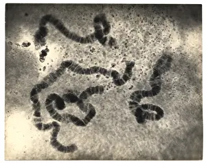 Mutation Prints: Chromosome Structure, Salivary Glands, Sciara