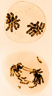 Chromosomes, Radiation Damage, TEM