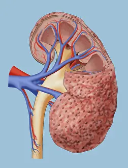Diabetic Prints: Chronic Kidney Disease, Illustration